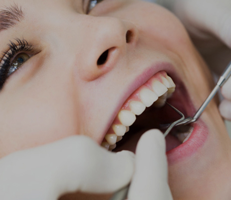 IStudio Dentistico Pavanello | Igiene dentale
