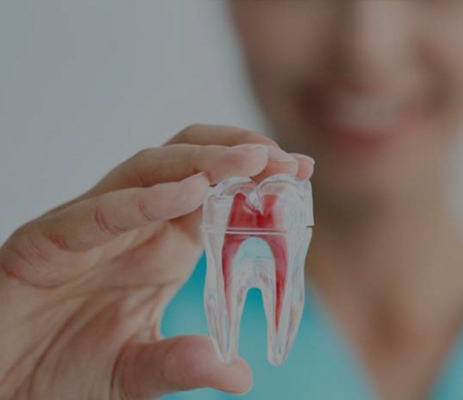 Studio Dentistico Pavanello | endodonzia